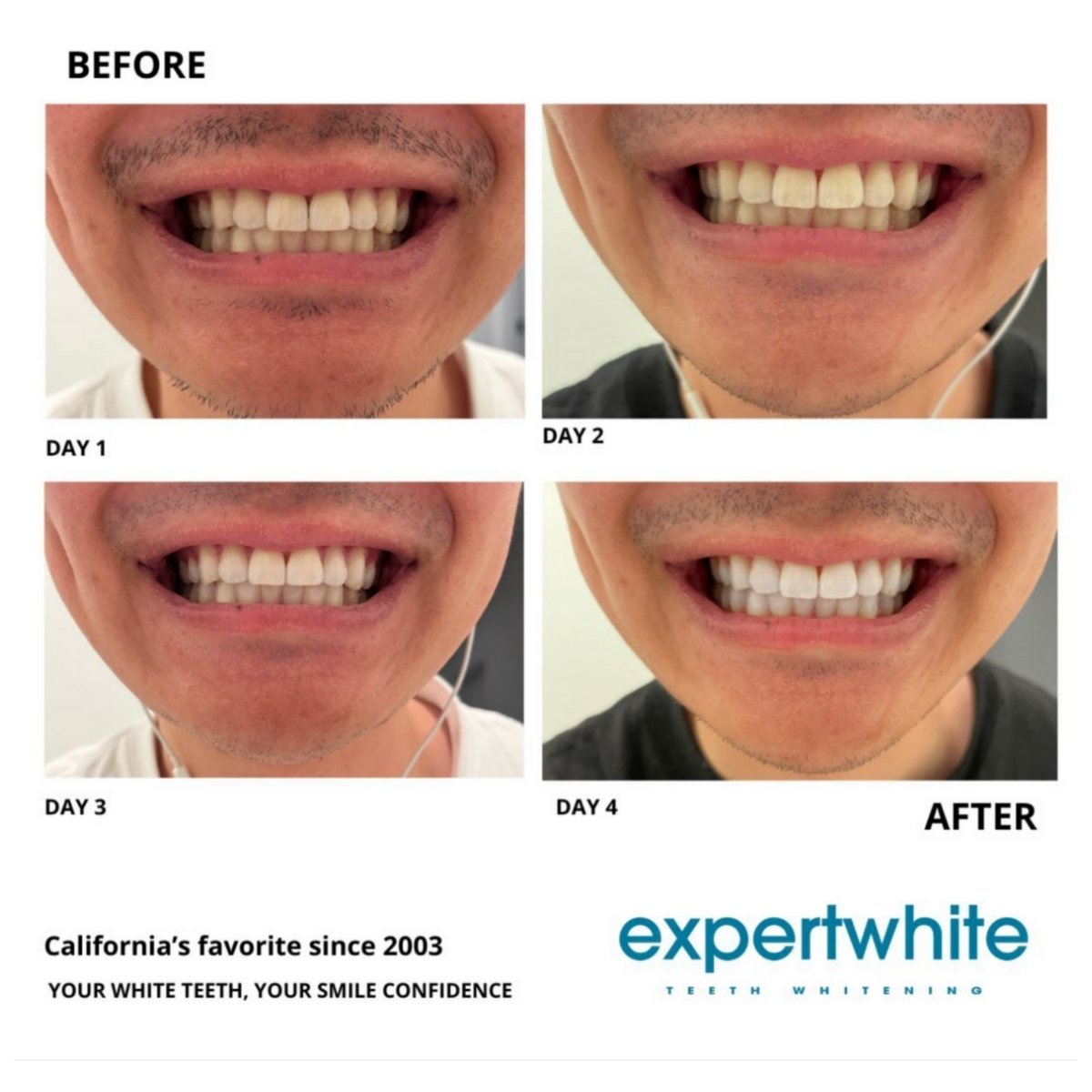 Expertwhite® Instant Glow Whitening Strips